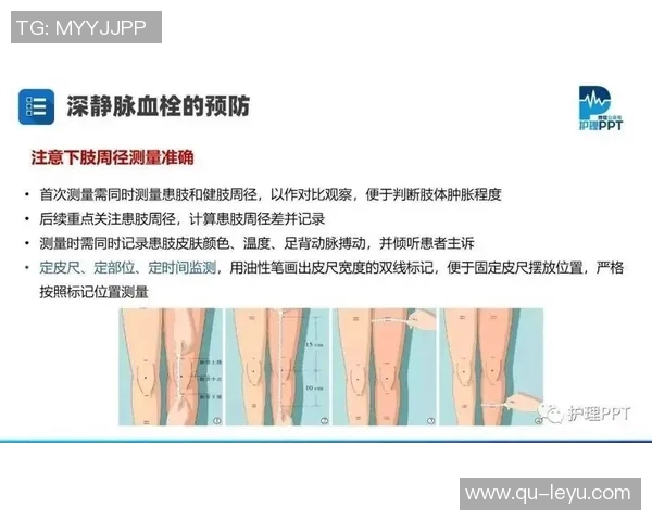 文班谈血栓伤病的医学分析与心理状态的积极应对 文班谈血栓伤病的医学分析与心理状态的积极应对